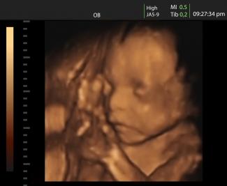 3d_ultrasound.jpg