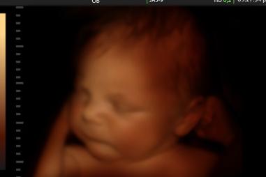 Unborn-baby-late-term-810x500.jpeg