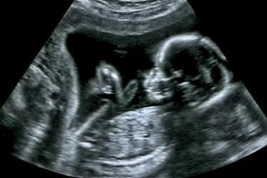 baby_in_the_womb-e1739799020930-810x500.jpg