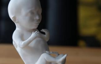 3D_printed_ultrasound.jpg