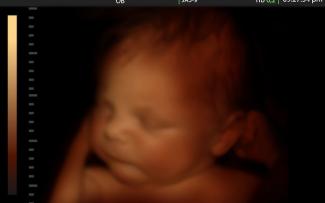 Unborn-baby-late-term-810x500.jpeg