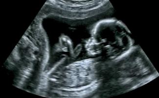 baby_in_the_womb-e1739799020930-810x500.jpg