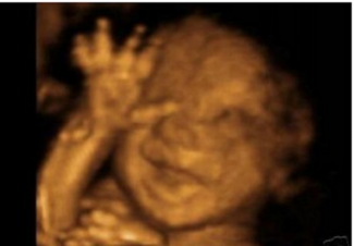 ultrasound3d13b.png